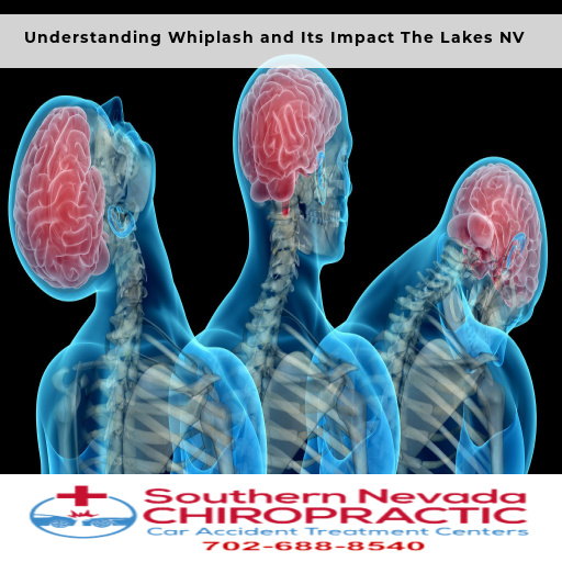 Understanding Whiplash - Las Vegas Whiplash Chiropractor The Lakes